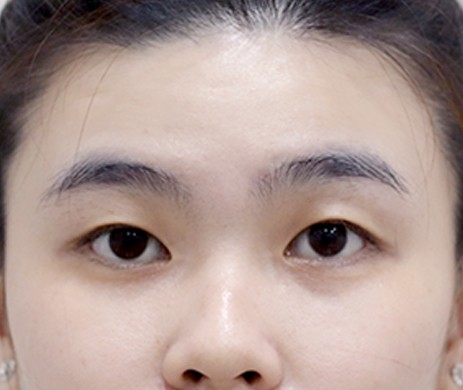 Nhấn Mí