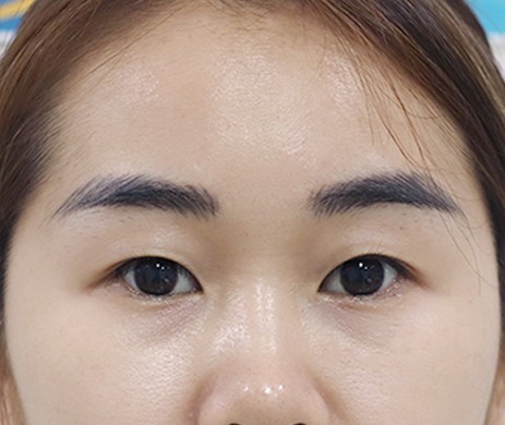 Nhấn Mí