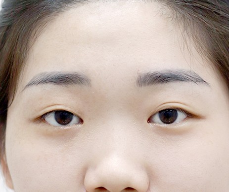 Nhấn Mí