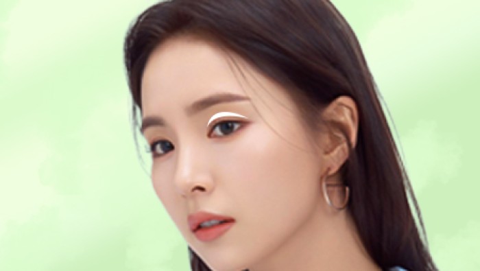 Cắt da mỡ thừa mí trên