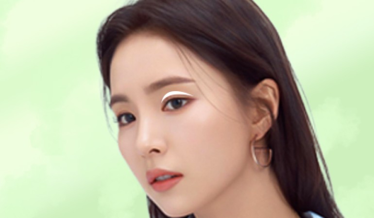 Cắt da mỡ thừa mí trên